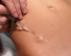 terapia neural